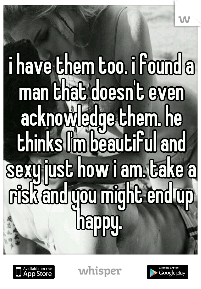  i have them too. i found a man that doesn't even acknowledge them. he thinks I'm beautiful and sexy just how i am. take a risk and you might end up happy. 