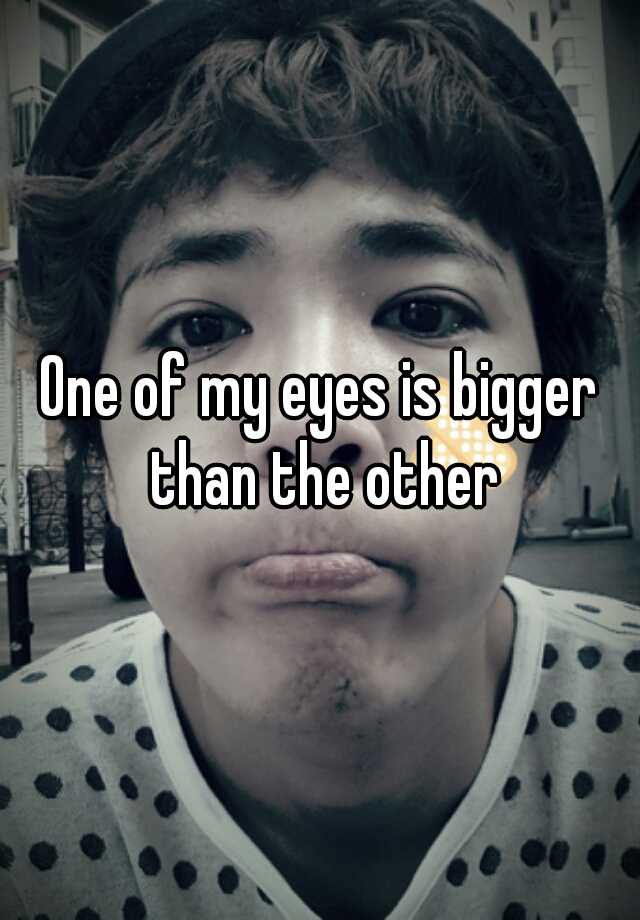 one-of-my-eyes-is-bigger-than-the-other