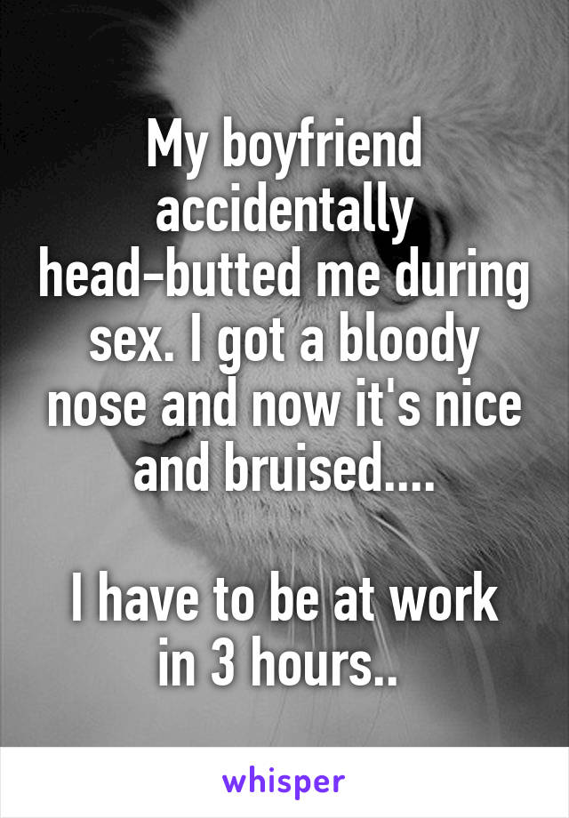 My boyfriend accidentally head-butted me during sex. I got a bloody nose and now it's nice and bruised....

I have to be at work in 3 hours.. 