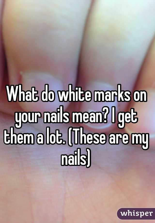 what-do-white-marks-on-your-nails-mean-i-get-them-a-lot-these-are-my