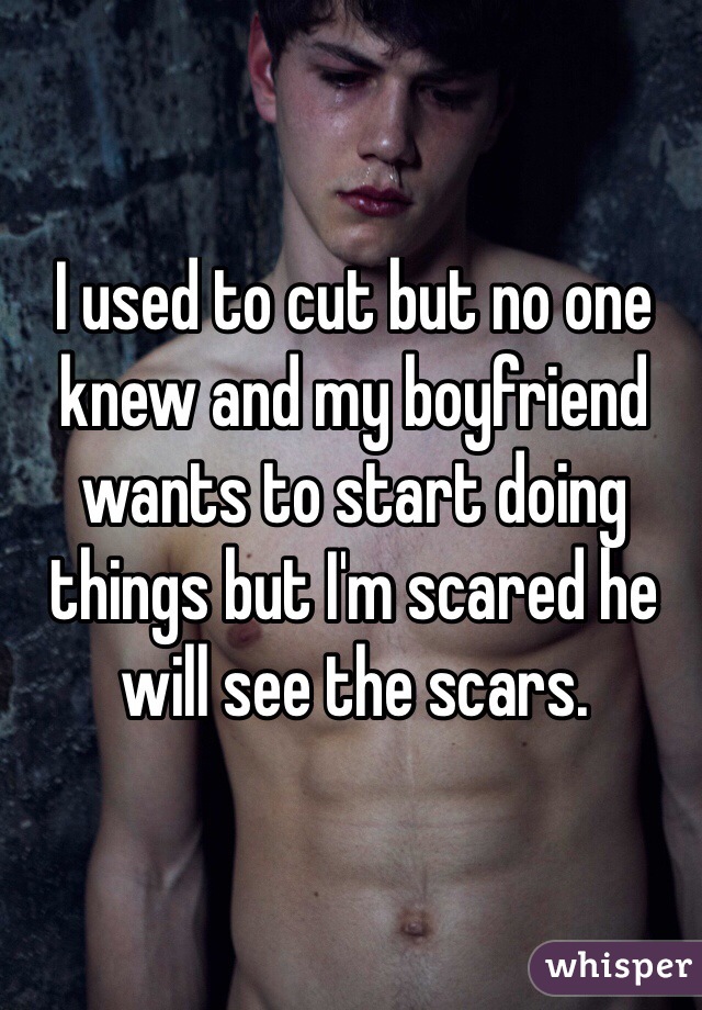 I used to cut but no one knew and my boyfriend wants to start doing things but I'm scared he will see the scars.
