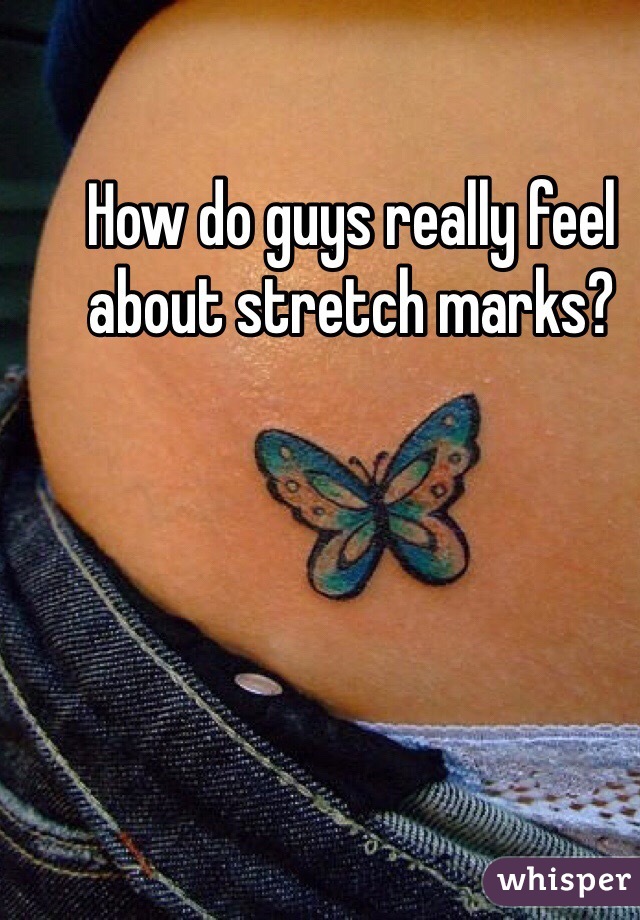 How do guys really feel about stretch marks? 
