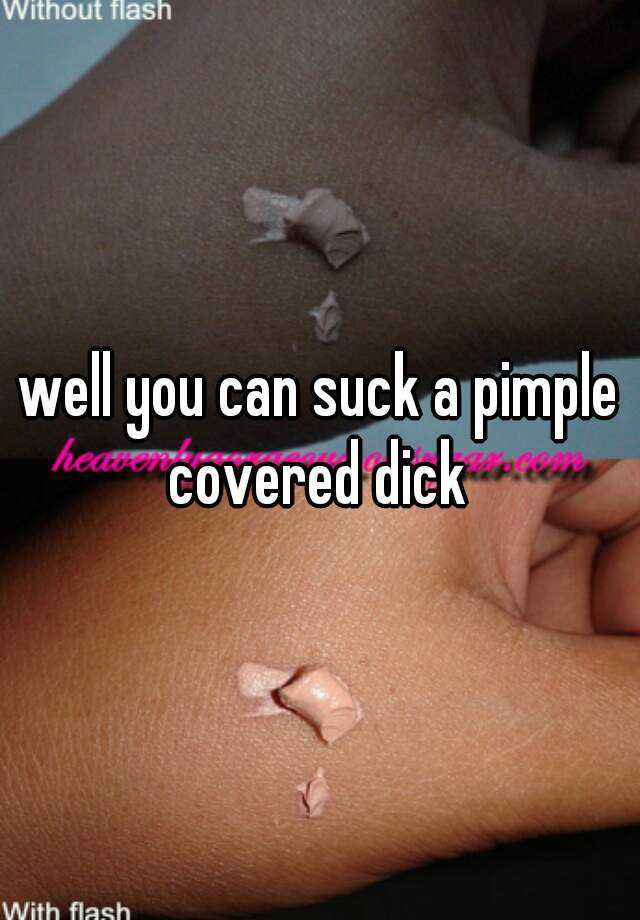 Dick zit on Pimple on