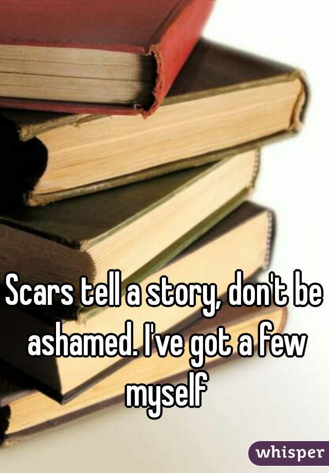 Scars tell a story, don't be ashamed. I've got a few myself