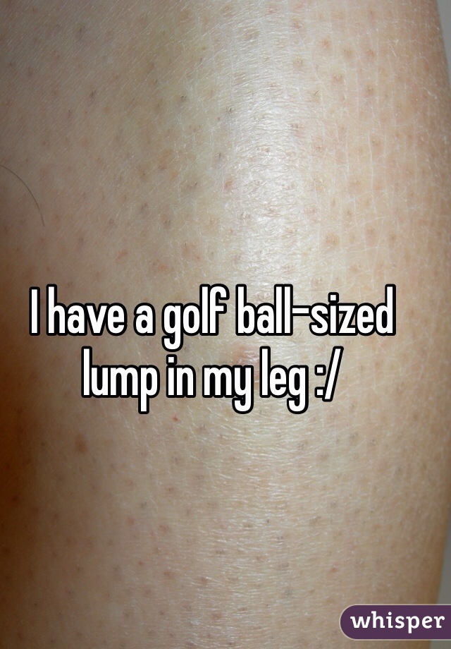 i-have-a-golf-ball-sized-lump-in-my-leg