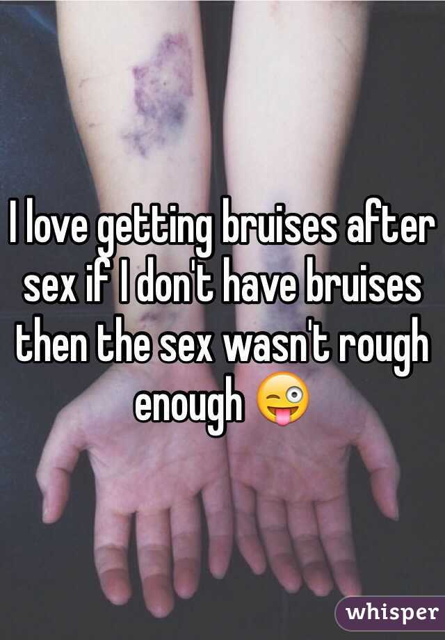 I love getting bruises after sex if I don't have bruises then the sex wasn't rough enough 😜