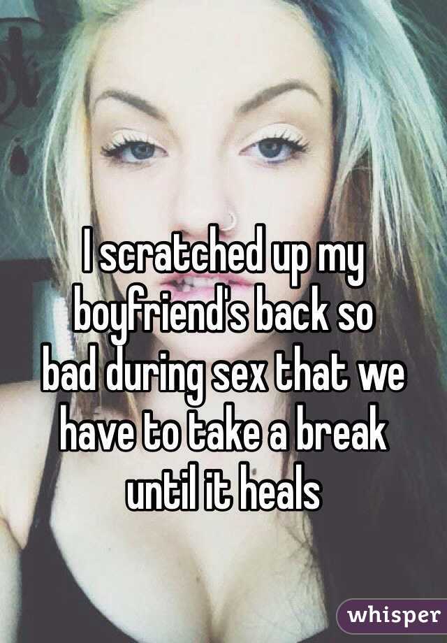 I scratched up my boyfriend's back so 
bad during sex that we have to take a break 
until it heals