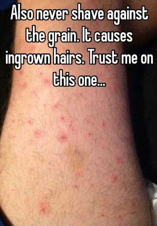 Also Never Shave Against The Grain It Causes Ingrown Hairs Trust