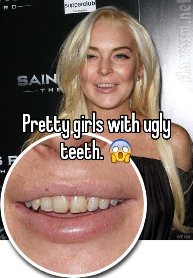 pictures of women with ugly teeth