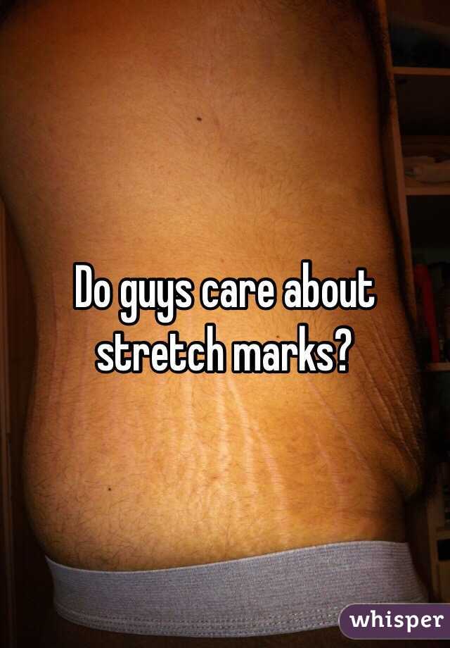 Think what about stretch marks guys do Do men