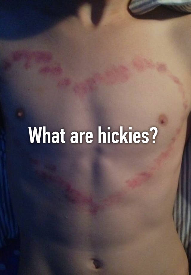 What are hickies?