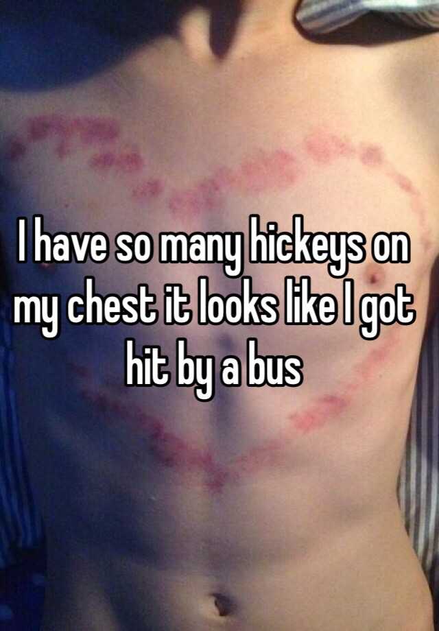 Hickeys on chest