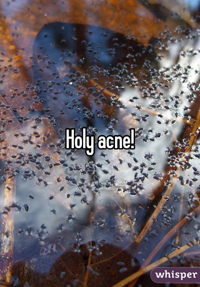 Holy acne! 