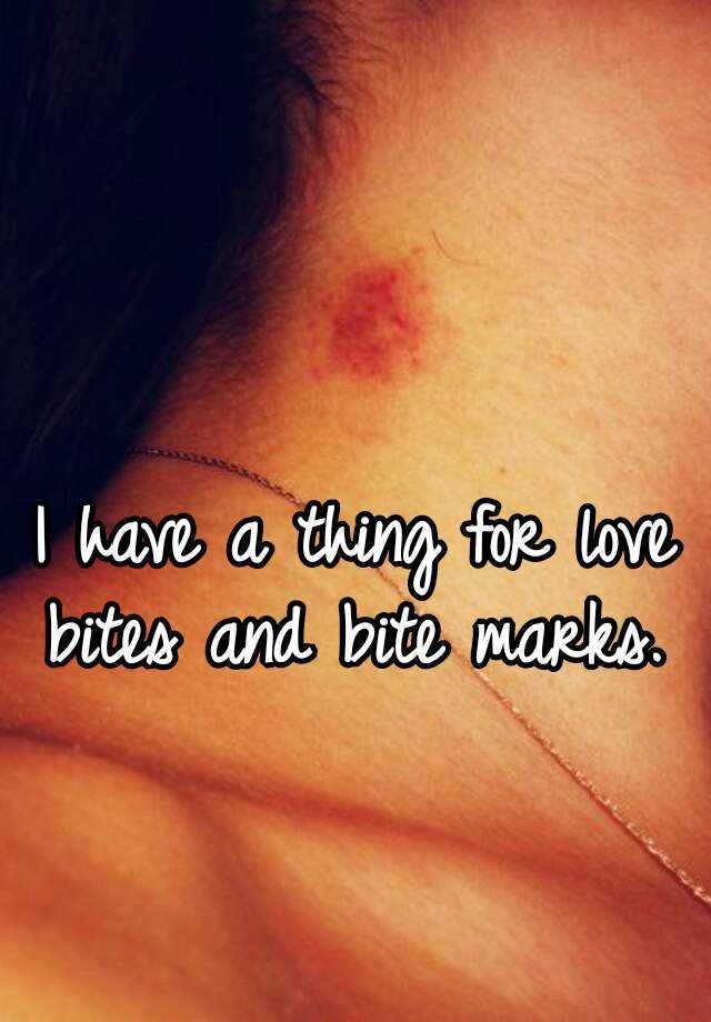 I Have A Thing For Love Bites And Bite Marks 