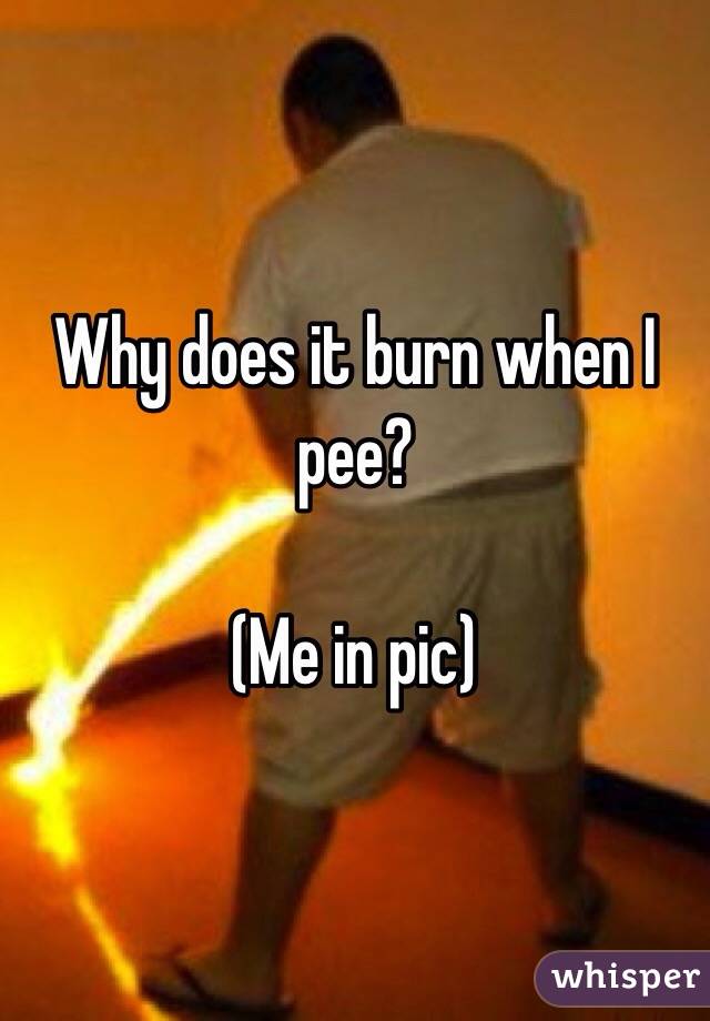 Proč tě bolí oheň?