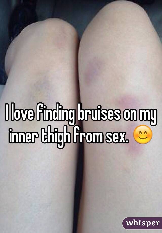 Bruises legs sex on How to