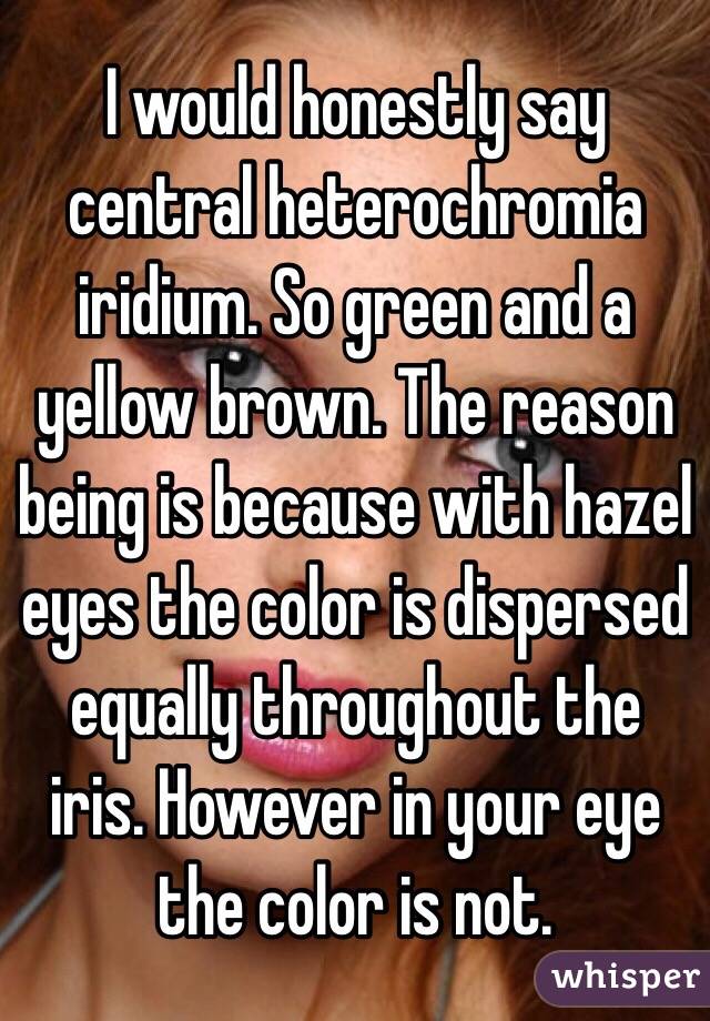 central heterochromia vs hazel