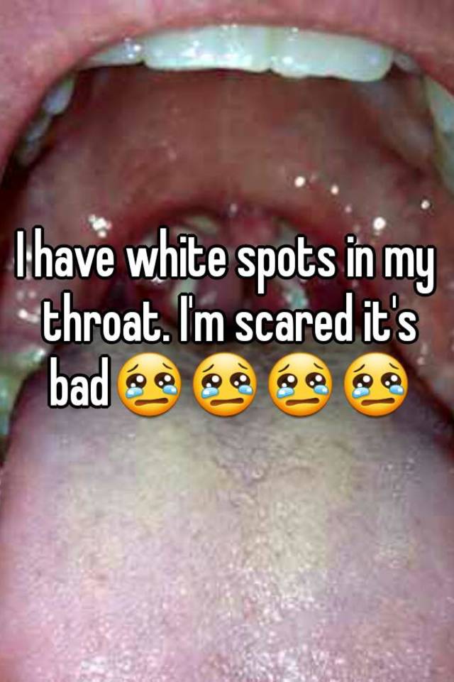 I Have White Spots In My Throat Im Scared Its Bad😢😢😢😢