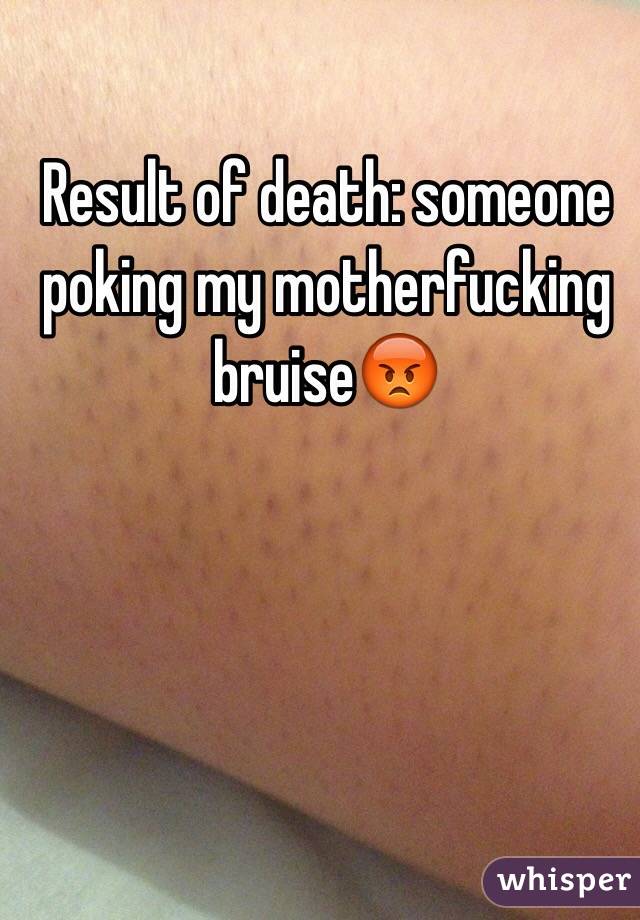 Result of death: someone poking my motherfucking bruise😡