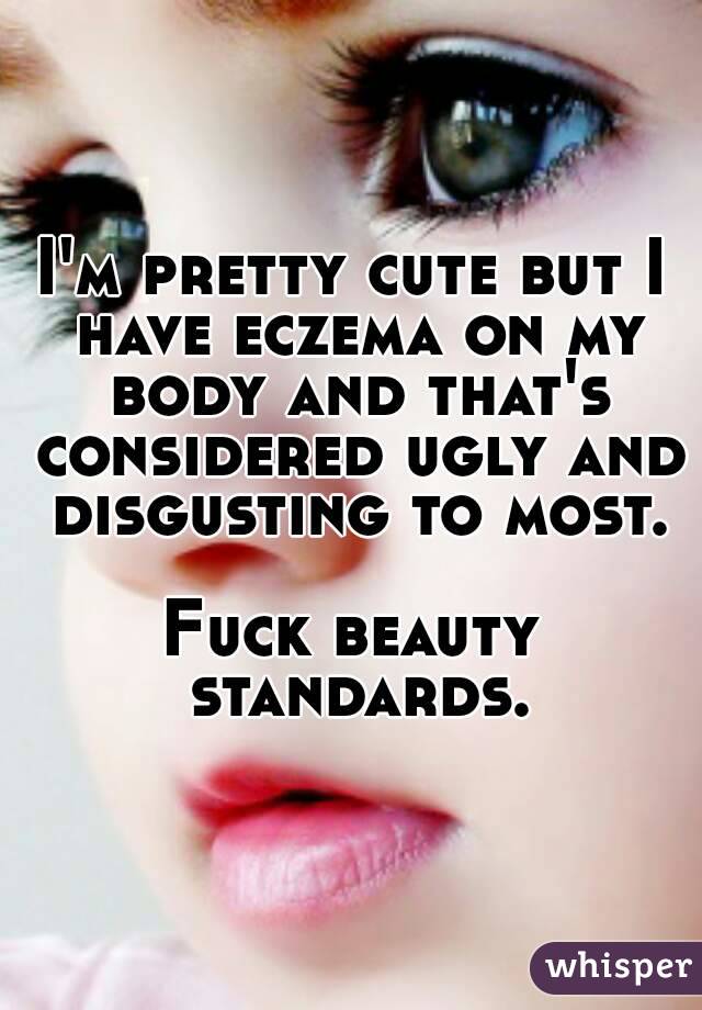 I'm pretty cute but I have eczema on my body and that's considered ugly and disgusting to most.

Fuck beauty standards.