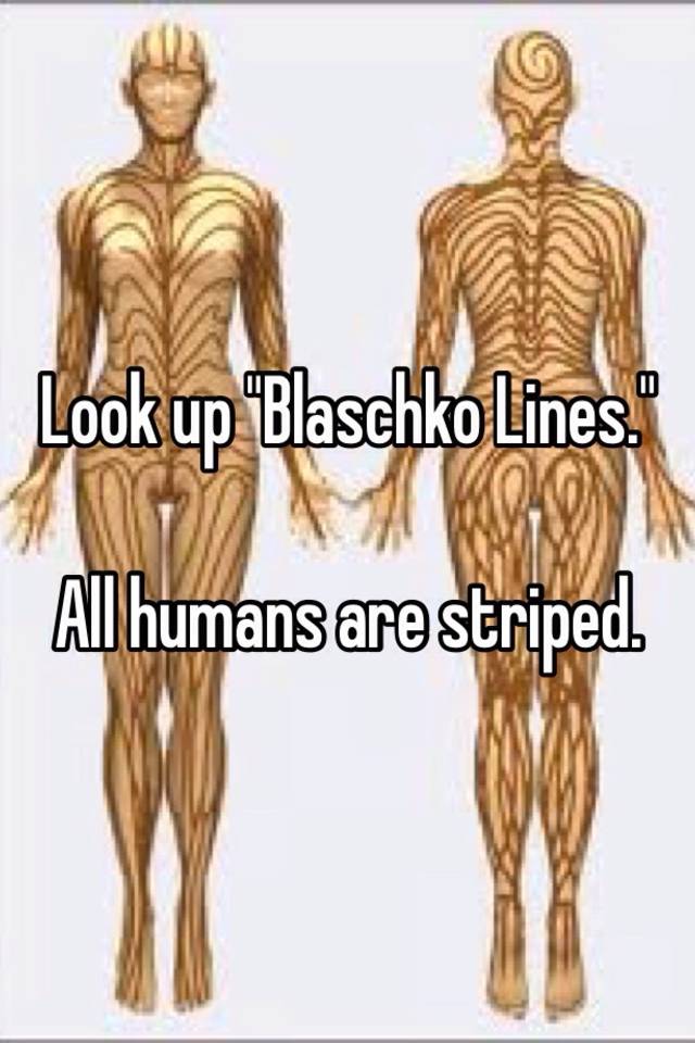 humans have stripes