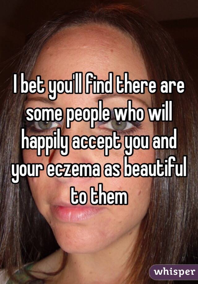 I bet you'll find there are some people who will happily accept you and your eczema as beautiful to them