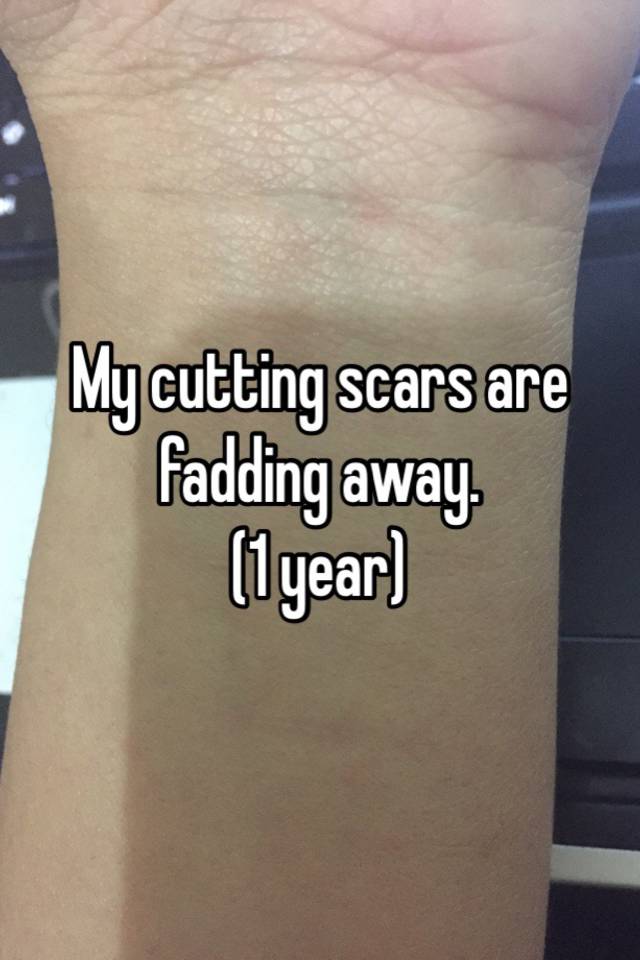 My cutting scars are fadding away. (1 year)