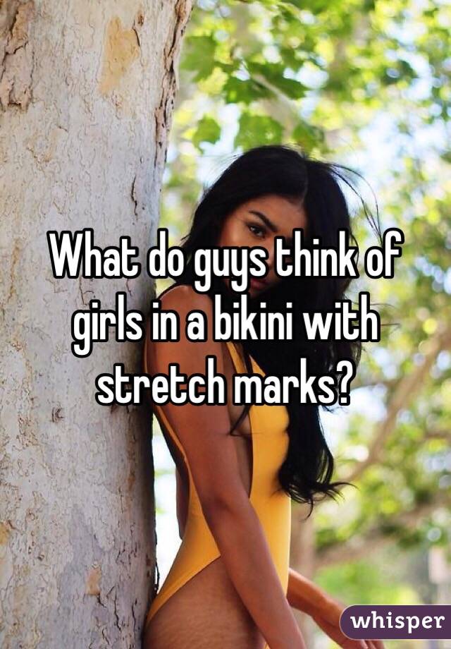 What do guys think about stretch marks