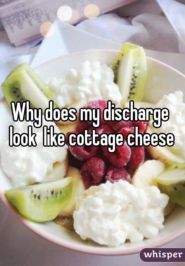 Why Does My Discharge Look Like Cottage Cheese