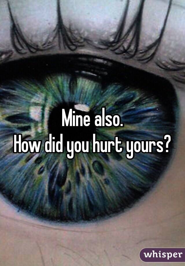 Mine also.
How did you hurt yours?