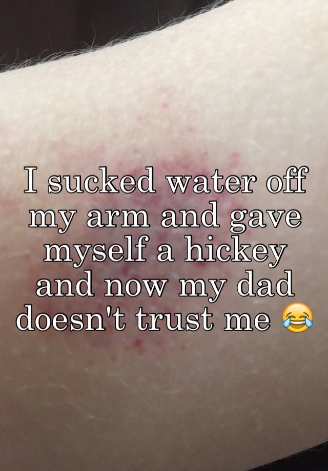 Can You Give Yourself A Hickey On Your Arm I Sucked Water Off My Arm And Gave Myself A Hickey And Now My Dad Doesn T Trust Me