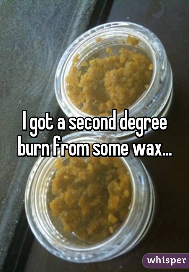 Waxing from degree second burn Waxing Burn: