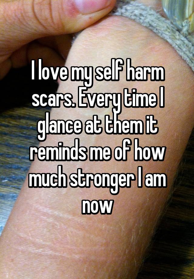 I love my self harm scars. 