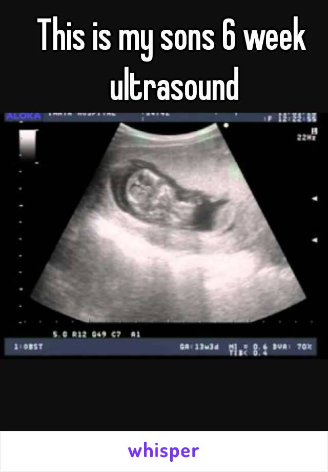 See ultrasound 6 on you what week should a Often asked: