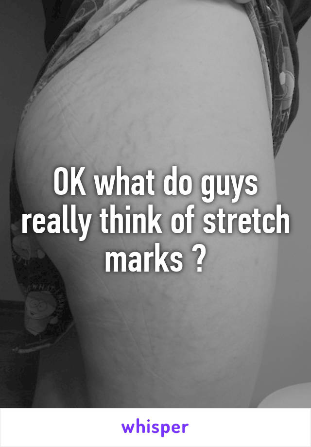 OK what do guys really think of stretch marks ?