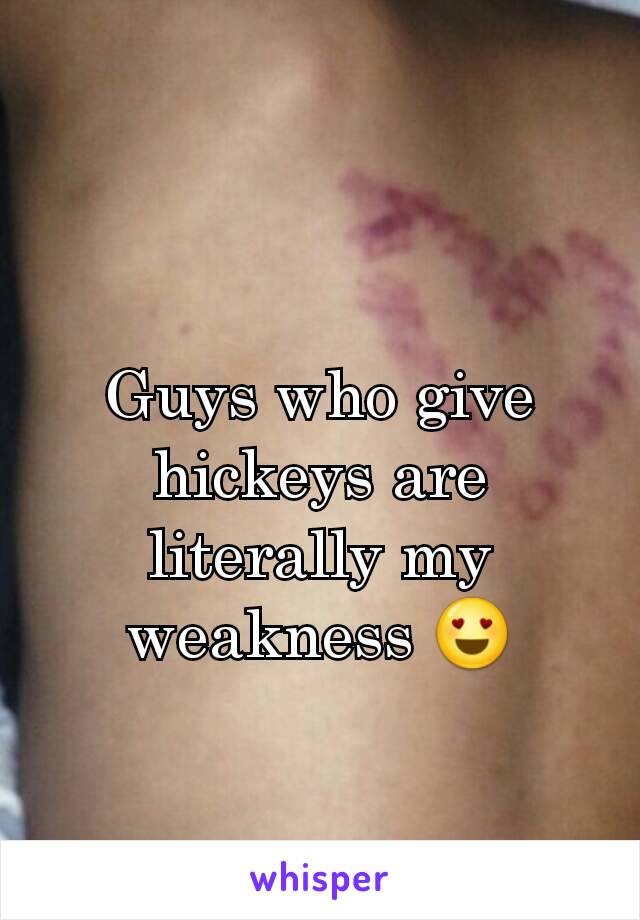 Guys with hickeys