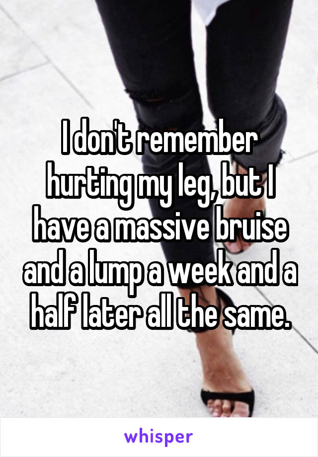 I don't remember hurting my leg, but I have a massive bruise and a lump a week and a half later all the same.