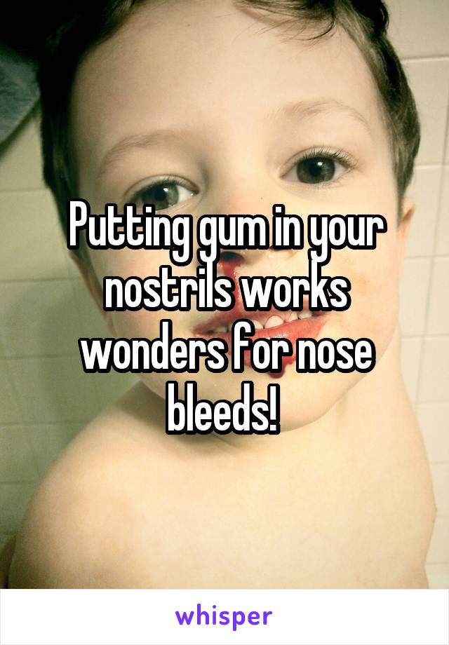 Putting gum in your nostrils works wonders for nose bleeds! 