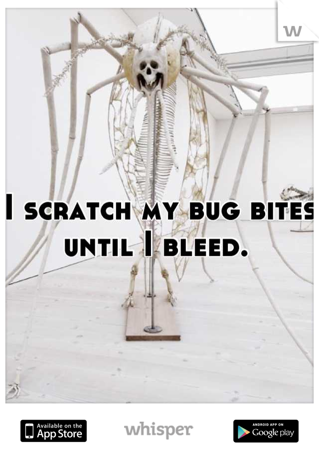 I scratch my bug bites until I bleed. 