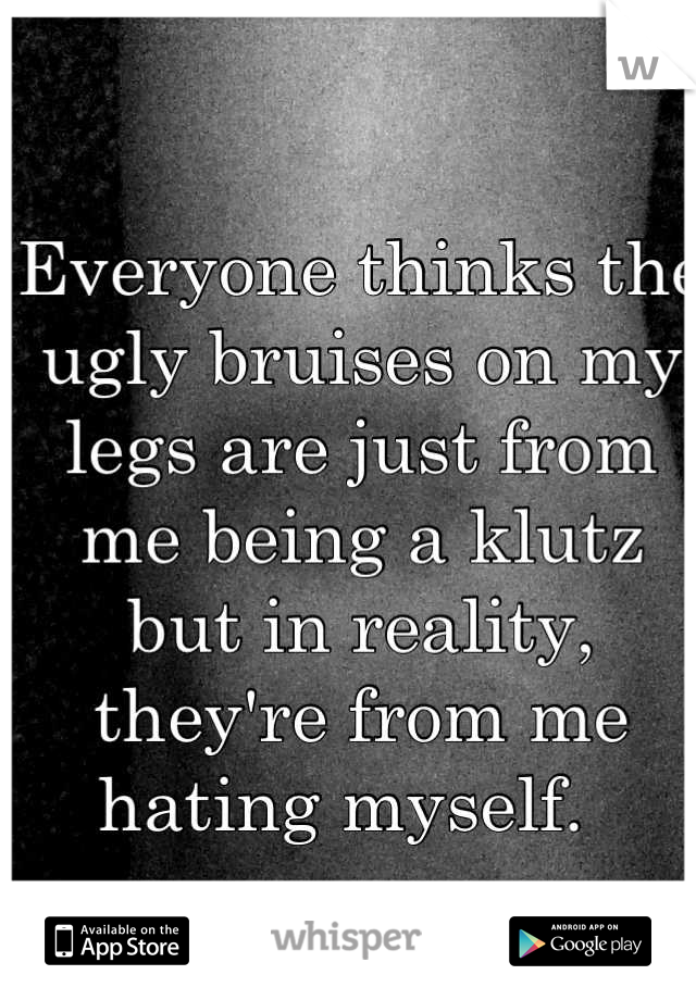 Everyone thinks the ugly bruises on my legs are just from me being a klutz but in reality, they're from me hating myself.  