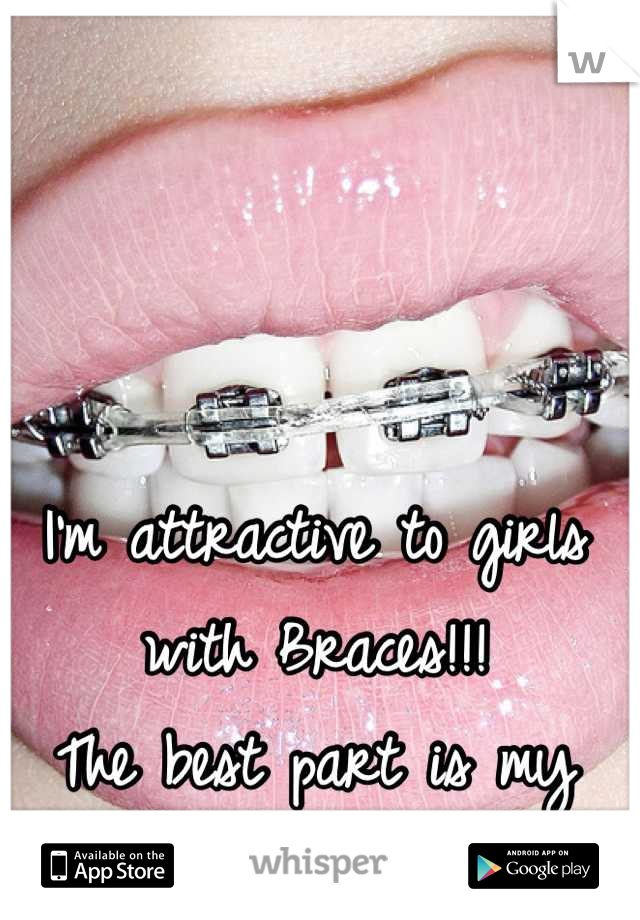 I'm attractive to girls with Braces!!!
The best part is my GF has them <3