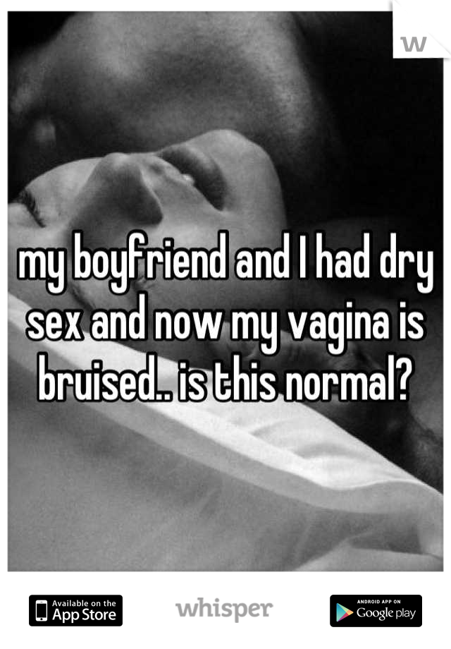 my boyfriend and I had dry sex and now my vagina is bruised.. is this normal?