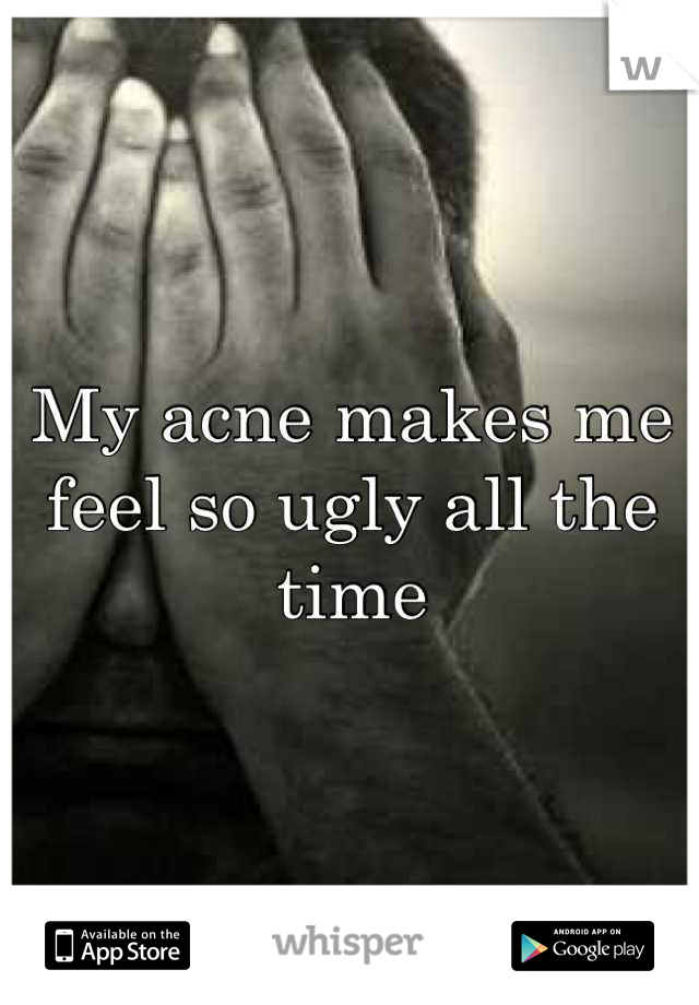 My acne makes me feel so ugly all the time