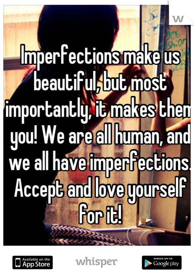 Imperfections make us beautiful, but most importantly, it makes them you! We are all human, and we all have imperfections. Accept and love yourself for it!