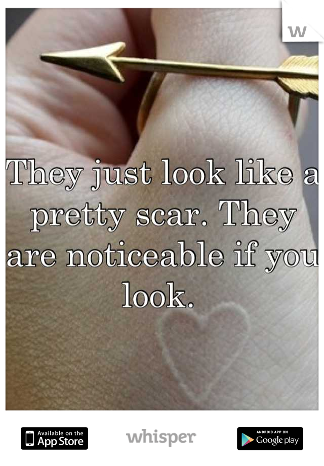 They just look like a pretty scar. They are noticeable if you look. 
