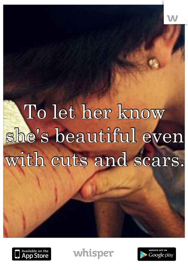 To let her know she's beautiful even with cuts and scars.