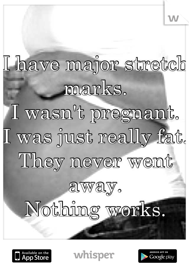 I have major stretch marks.
I wasn't pregnant.
I was just really fat.
They never went away.
Nothing works.