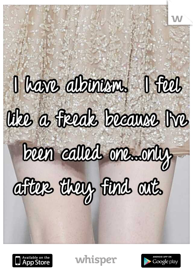 I have albinism.  I feel like a freak because I've been called one...only after they find out.  