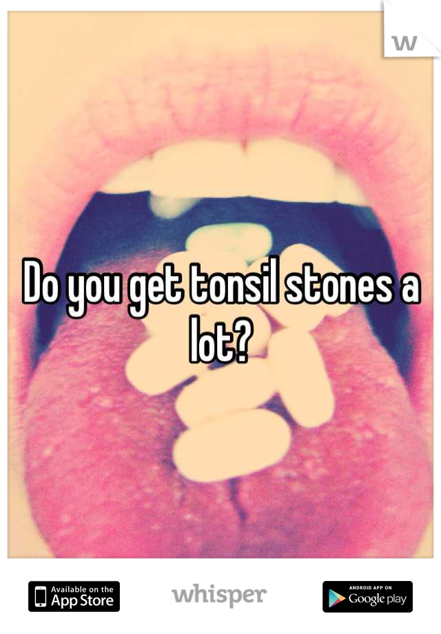 Do you get tonsil stones a lot?