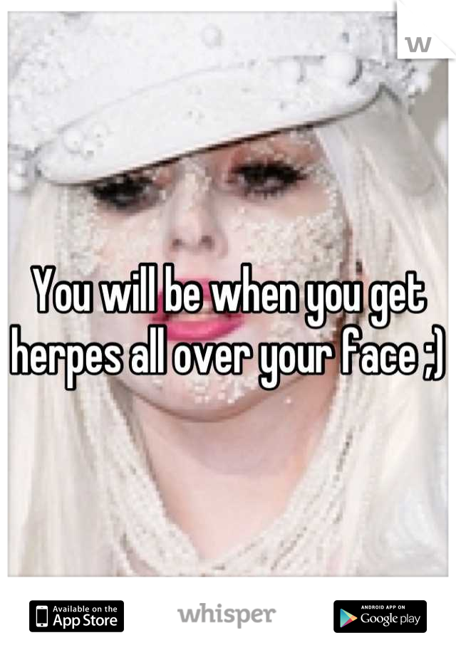 You will be when you get herpes all over your face ;)